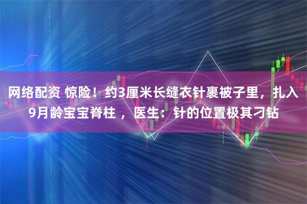 网络配资 惊险！约3厘米长缝衣针裹被子里，扎入9月龄宝宝脊柱 ，医生：针的位置极其刁钻